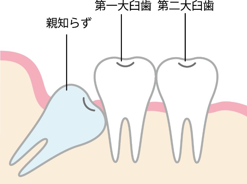 歯科口腔外科とは